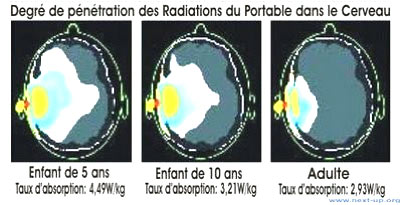 Schéma du degré de pénétration des ondes dans le cerveau